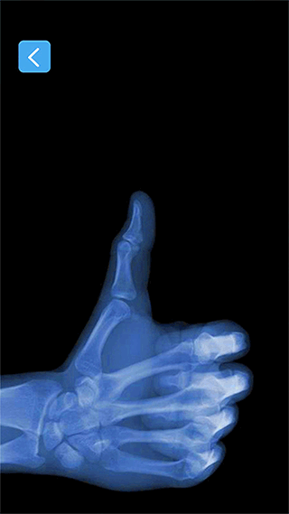 x射线模拟器(辐射检测仪)图片1