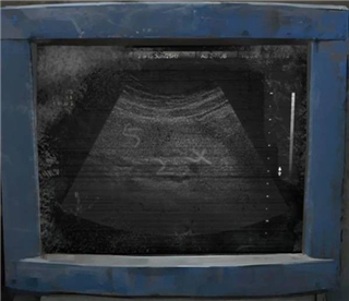 纸嫁衣8千子树游戏图片13